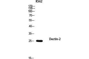 Western Blot (WB) analysis of K562 using Dectin-2 antibody. (C-Type Lectin Domain Family 6, Member A (CLEC6A) antibody)