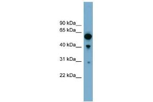 ARHGAP15 antibody used at 1 ug/ml to detect target protein. (ARHGAP15 antibody  (Middle Region))