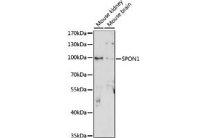 Western blot analysis of extracts of various cell lines, using SPON1 antibody (ABIN7270552) at 1:1000 dilution. (SPON1 antibody  (AA 29-300))