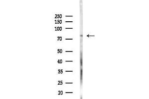 anti-Poly (ADP-Ribose) Polymerase Family, Member 12 (PARP12) antibody