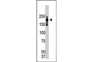 Western blot analysis of PRDM2 monoclonal antibody, clone 33AT1045  in lysate from transformed cells. (PRDM2 antibody  (AA 1-347))