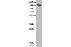 Western blot All lanes: NPHP3 antibody at 1. (NPHP3 antibody  (AA 1-130))