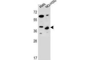 Western Blotting (WB) image for anti-Protein Phosphatase 1, Regulatory Subunit 42 (PPP1R42) antibody (ABIN2996758)