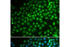 Immunofluorescence analysis of HeLa cells using SMARCA5 Polyclonal Antibody (SMARCA5 antibody)