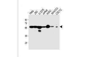 All lanes : Anti-VIME Antibody at 1:4000 dilution Lane 1: Hela whole cell lysate Lane 2: 293 whole cell lysate Lane 3: U-2OS whole cell lysate Lane 4: Jurkat whole cell lysate Lane 5: K562 whole cell lysate Lane 6: NIH/3T3 whole cell lysate Lane 7: C2C12 whole cell lysate Lysates/proteins at 20 μg per lane. (Vimentin antibody)