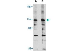 Western blot analysis of DLGAP2 in L1210 cell lysate with DLGAP2 polyclonal antibody  at (A) 0. (DLGAP2 antibody  (Internal Region))