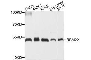 Western blot analysis of extracts of various cell lines, using RBM22 antibody.