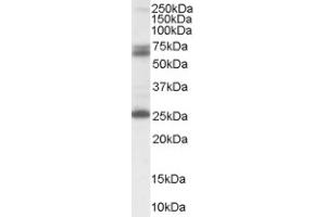 Image no. 1 for anti-Glutamate Decarboxylase 2 (Pancreatic Islets and Brain, 65kDa) (GAD2) (Internal Region) antibody (ABIN374550) (GAD65 antibody  (Internal Region))