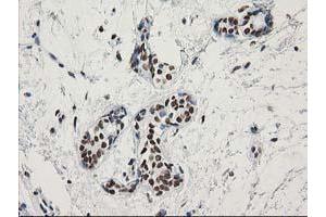 Immunohistochemical staining of paraffin-embedded Human breast tissue using anti-LENG1 mouse monoclonal antibody. (Leng1 antibody)