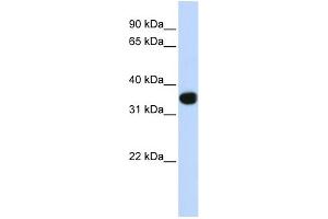 WB Suggested Anti-TLX1 Antibody Titration:  0. (TLX1 antibody  (Middle Region))