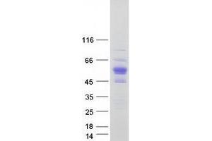 Zinc Finger Protein 704 (ZNF704) protein (Myc-DYKDDDDK Tag)