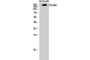 Western Blotting (WB) image for anti-Collagen, Type IV, alpha 1 (COL4A1) (N-Term) antibody (ABIN5956219) (COL4A1 antibody  (N-Term))