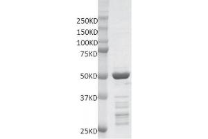 Recombinant MLL / HRX - SET protein gel. (MLL/KMT2A Protein (AA 3735-3973) (GST tag))