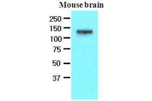The extracts of mouse brain (50 ug) were resolved by SDS-PAGE, transferred to nitrocellulose membrane and probed with anti-human EphA2 (1:500). (EPH Receptor A2 antibody  (AA 559-976))