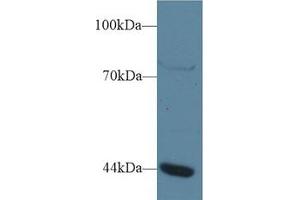 Western Blot; Sample: Human Jurkat cell lysate; Primary Ab: 1µg/ml Rabbit Anti-Human GTF3A Antibody Second Ab: 0. (GTF3A antibody  (AA 71-365))