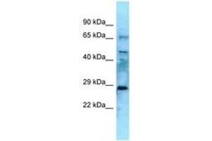Image no. 1 for anti-Eyes Absent Homolog 4 (EYA4) (N-Term) antibody (ABIN6748312) (EYA4 antibody  (N-Term))