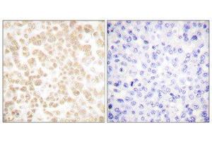 Immunohistochemistry (IHC) image for anti-FOS-Like Antigen 2 (FOSL2) (C-Term) antibody (ABIN1848553) (FOSL2 antibody  (C-Term))