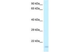 Image no. 1 for anti-Glycoprotein IX (Platelet) (GP9) (AA 61-110) antibody (ABIN6747603) (CD42a antibody  (AA 61-110))