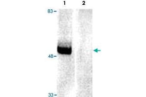 PARK2 immunoreactivity of rat brain extracts and immunobloted with PARK2 polyclonal antibody  .