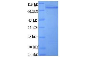 SDS-PAGE (SDS) image for Angiopoietin-Like 4 (ANGPTL4) (AA 28-403), (partial) protein (GST tag) (ABIN1046545)