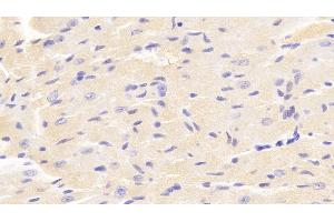 Detection of VAV1 in Mouse Cardiac Muscle Tissue using Polyclonal Antibody to Vav 1 Oncogene (VAV1) (VAV1 antibody  (AA 565-795))