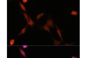Immunofluorescence (IF) image for anti-Proteasome Subunit alpha  7 (PSMA7) antibody (ABIN7260948)