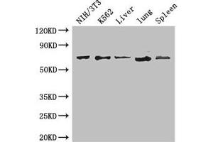 Western Blot Positive WB detected in: NIH/3T3 whole cell lysate, K562 whole cell lysate, Mouse liver tissue, Mouse lung tissue, Mouse spleen tissue All lanes: IL23R antibody at 3. (IL23R antibody  (AA 15-125))
