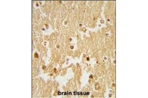 Formalin-fixed and paraffin-embedded human brain tissue reacted with ESRRB Antibody (Center), which was peroxidase-conjugated to the secondary antibody, followed by DAB staining.