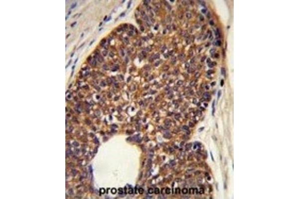 MTBP antibody