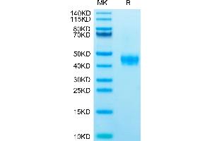 Human CCR8 on Tris-Bis PAGE under reduced condition. (CCR8 Protein (AA 1-35) (mFc Tag))