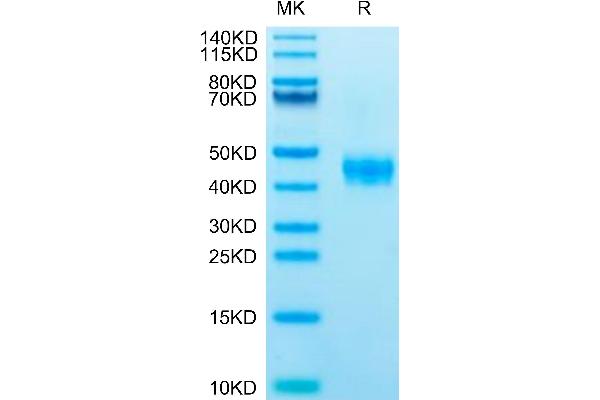 CCR8 Protein (AA 1-35) (mFc Tag)