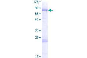 Poly (ADP-Ribose) Polymerase Family, Member 15 (PARP15) (AA 1-444) protein (GST tag)