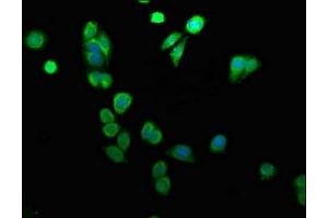 Immunofluorescence staining of HepG2 cells with ABIN7144779 at 1:100, counter-stained with DAPI. (ARID3A antibody  (AA 26-137))