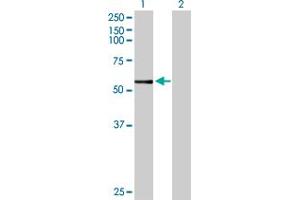 Western Blot analysis of CYP3A7 expression in transfected 293T cell line by CYP3A7 MaxPab polyclonal antibody. (CYP3A7 antibody  (AA 1-503))