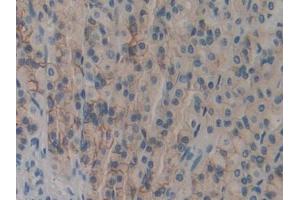 DAB staining on IHC-P; Samples: Rat Stomach Tissue (DOK7 antibody  (AA 63-320))