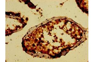 Immunohistochemistry of paraffin-embedded human testis tissue using ABIN7169116 at dilution of 1:100 (NEK9 antibody  (AA 821-979))