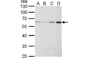 WB Image FGFR-5 antibody detects FGFR-5 protein by Western blot analysis.