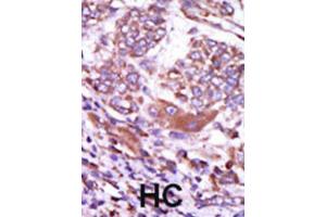 Immunohistochemistry (IHC) image for anti-Calcium/calmodulin-Dependent Protein Kinase II delta (CAMK2D) antibody (ABIN5023065) (CAMK2D antibody)