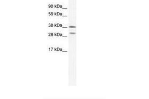 Image no. 1 for anti-NK2 Homeobox 3 (NKX2-3) (AA 34-83) antibody (ABIN202180) (NK2 Homeobox 3 antibody  (AA 34-83))
