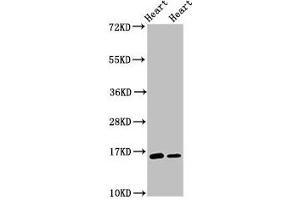 Western Blot Positive WB detected in: Rat heart tissue, Mouse heart tissue All lanes: C3orf14 antibody at 2. (C3ORF14 antibody  (AA 9-128))