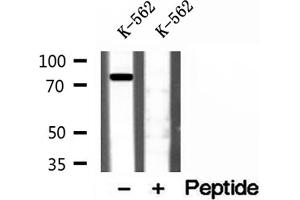 Western blot analysis of extracts of K-562 cells, using Coilin antibody. (Coilin antibody  (Internal Region))