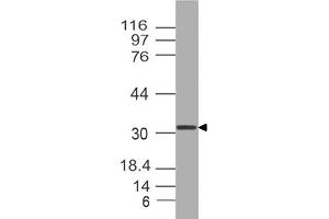 Image no. 1 for anti-Orthodenticle Homeobox 2 (OTX2) (AA 1-204) antibody (ABIN5027412) (OTX2 antibody  (AA 1-204))
