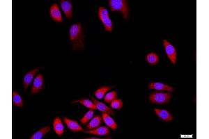 MCF-7 cells were stained with DLG1+3 Polyclonal Antibody, Unconjugated at 1:500 in PBS and incubated for two hours at 37°C followed by Goat Anti-Rabbit IgG (H+L) Cy3 conjugated secondary antibody.