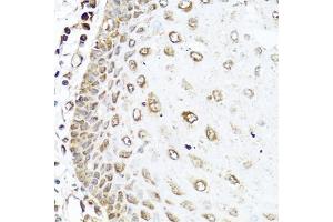 Immunohistochemistry of paraffin-embedded human esophagus using RAC2 antibody (ABIN5970487) at dilution of 1/100 (40x lens). (RAC2 antibody)