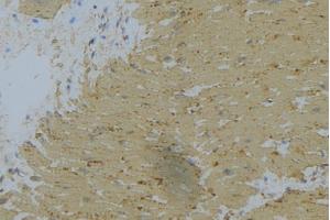 ABIN6269398 at 1/100 staining Mouse muscle tissue by IHC-P. (WNK1 antibody  (N-Term))