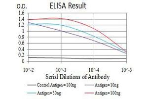 Black line: Control Antigen (100 ng),Purple line: Antigen (10 ng), Blue line: Antigen (50 ng), Red line:Antigen (100 ng) (IGLC2 antibody  (AA 1-106))