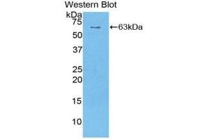 Western Blotting (WB) image for anti-Sulfatase 1 (SULF1) (AA 609-871) antibody (ABIN1860661) (SULF1 antibody  (AA 609-871))