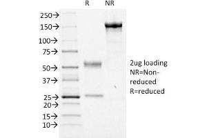 SDS-PAGE Analysis Purified FOXA1 Mouse Monoclonal Antibody (FOXA1/1516). (FOXA1 antibody  (AA 372-472))