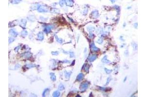 Immunohistochemistry (IHC) image for anti-Transforming Growth Factor, beta 1 (TGFB1) antibody (ABIN181152) (TGFB1 antibody)