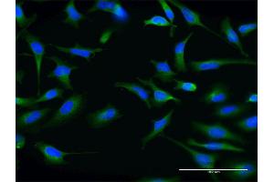 Immunofluorescence of monoclonal antibody to ABCG1 on HeLa cell. (ABCG1 antibody  (AA 21-130))